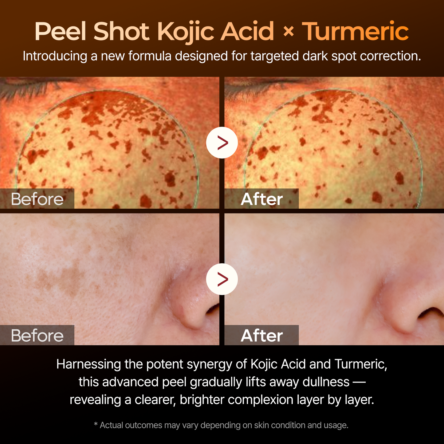 Peel Shot Kojik Acid Turmeric Serum