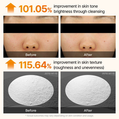 Peel Shot Kojik Acid Turmeric Serum