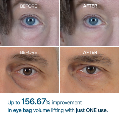 [SPECIAL 1+1 DEAL] Eyephalt eyebag cream